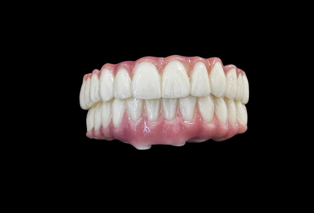 Detaliu al unor lucrări protetice full-arch din galeria DentElite