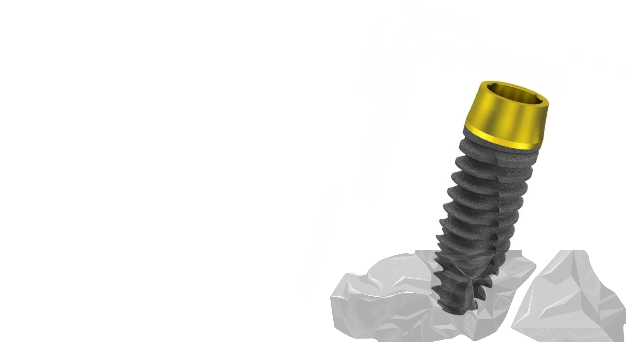 Implant dentar DentElite